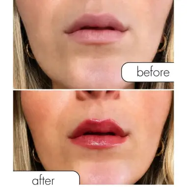 Matchmaker Crimson Kiss Brillo Labial Rojo Efecto Volumen